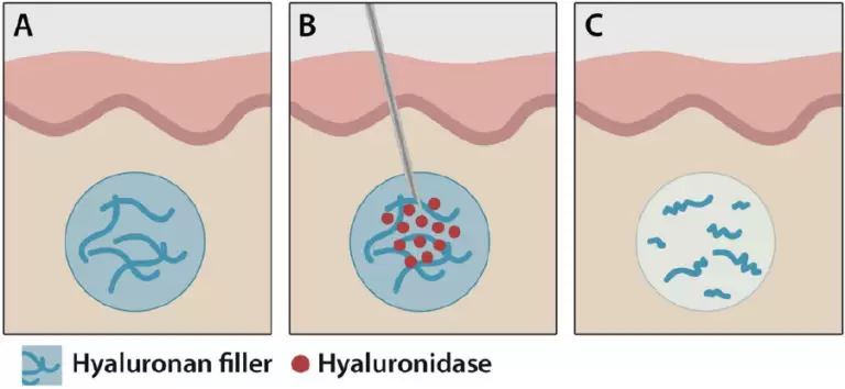 Complicatie spreekuur