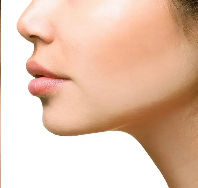 Na: Kincorrectie behandeling